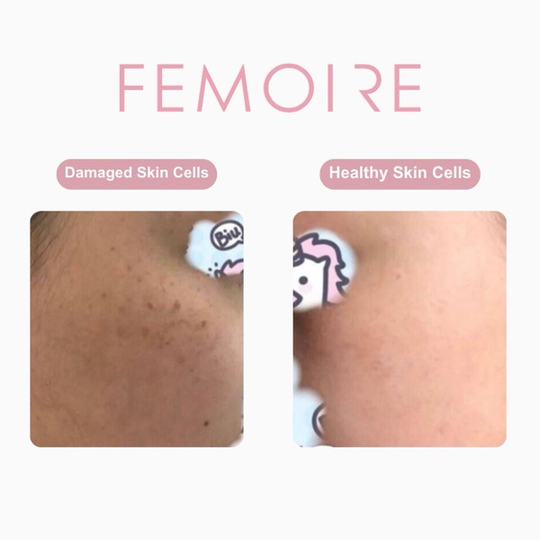 Customer WhatsApp before-and-after on Femoire