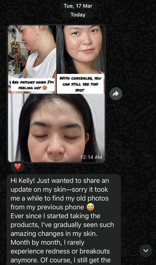 Customer WhatsApp: rarely any redness or breakouts month by month since starting Femoire