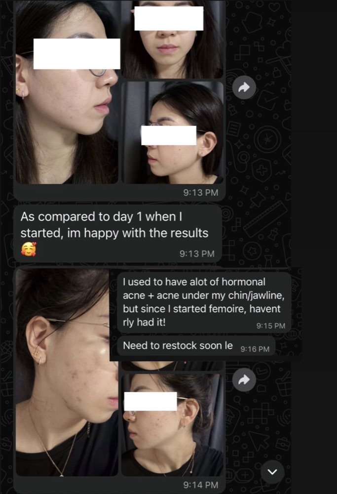 Customer WhatsApp: hormonal acne under chin and jawline cleared since starting Femoire, happy with results